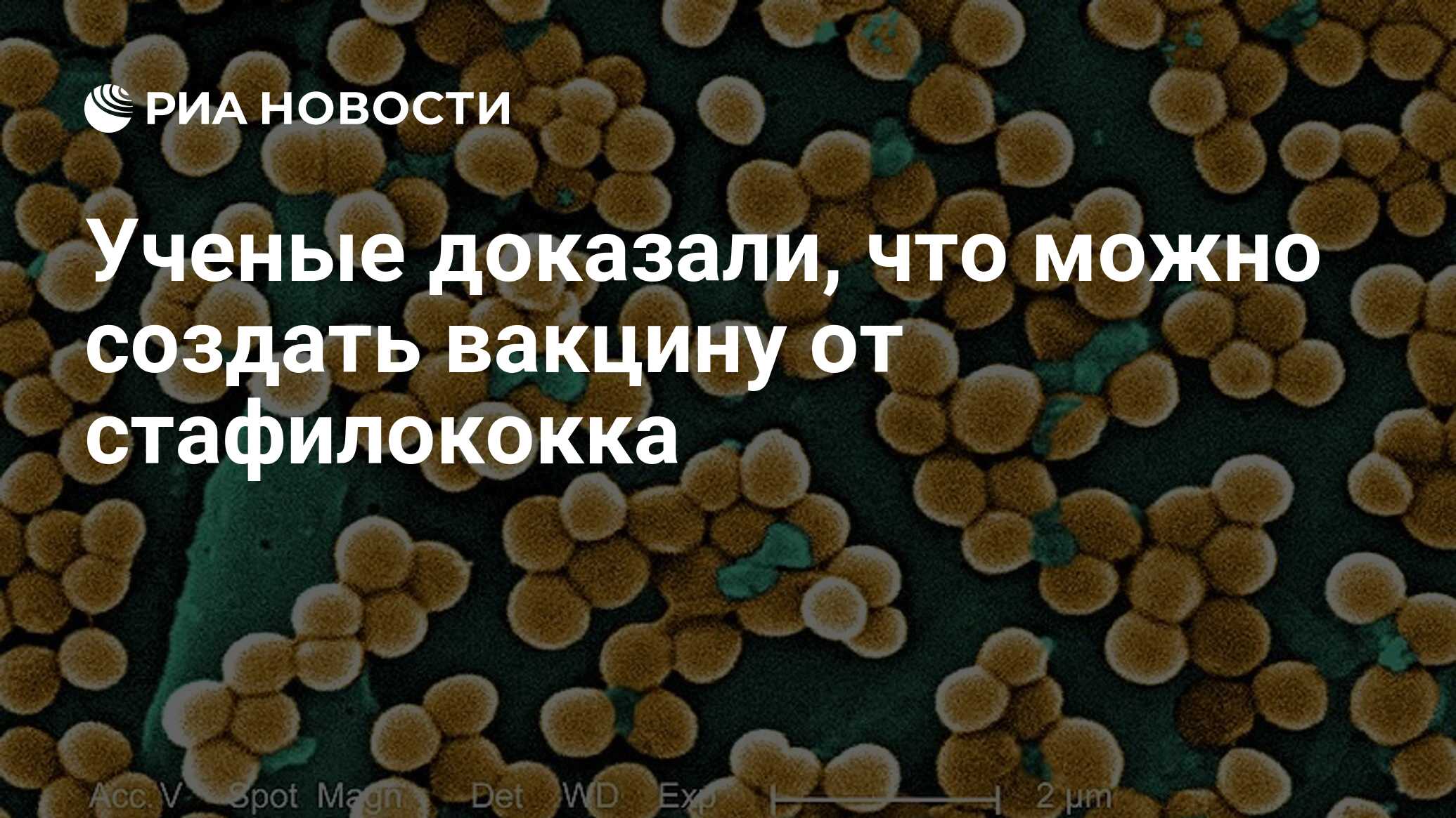 Ученые доказали, что можно создать вакцину от стафилококка - РИА Новости,  30.06.2020