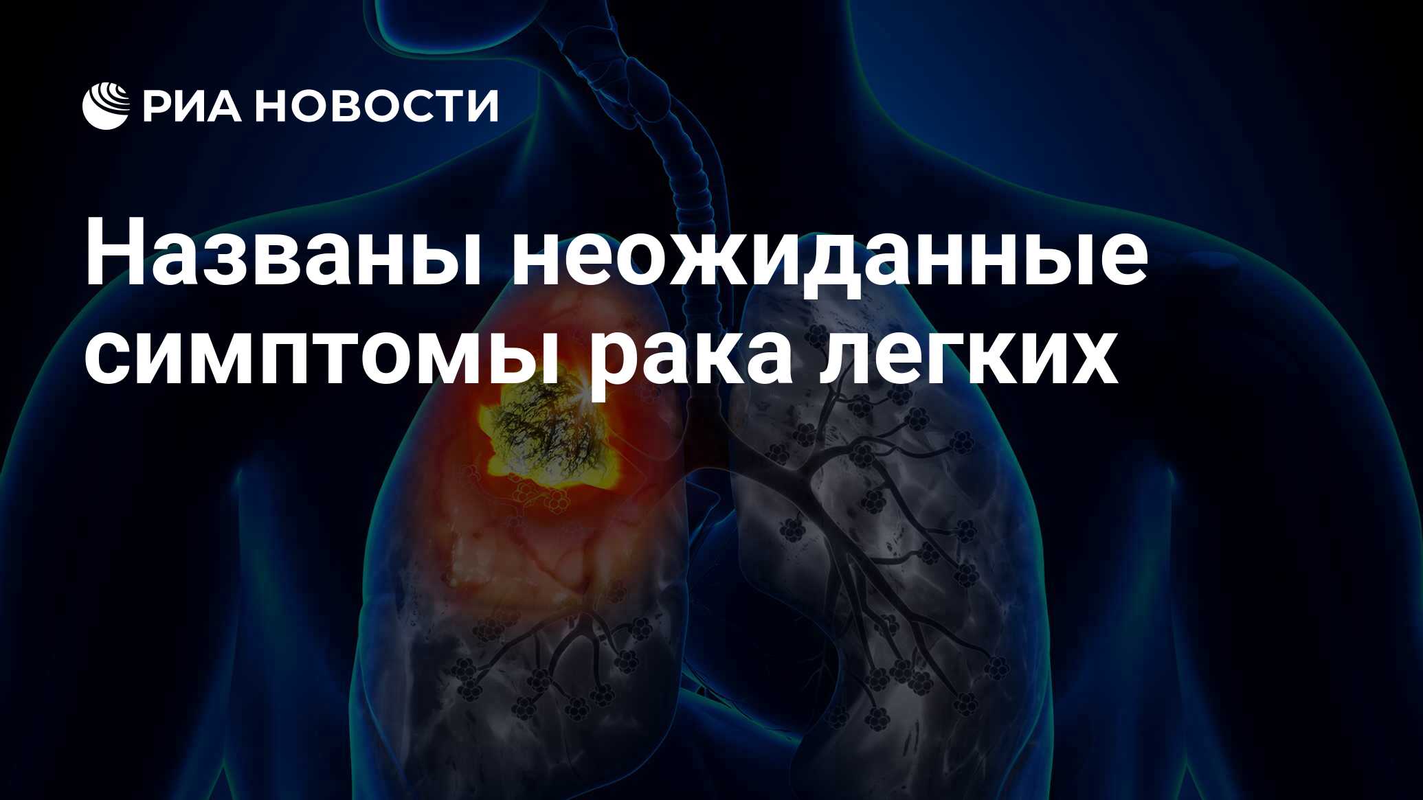 Рак легких симптомы отзывы