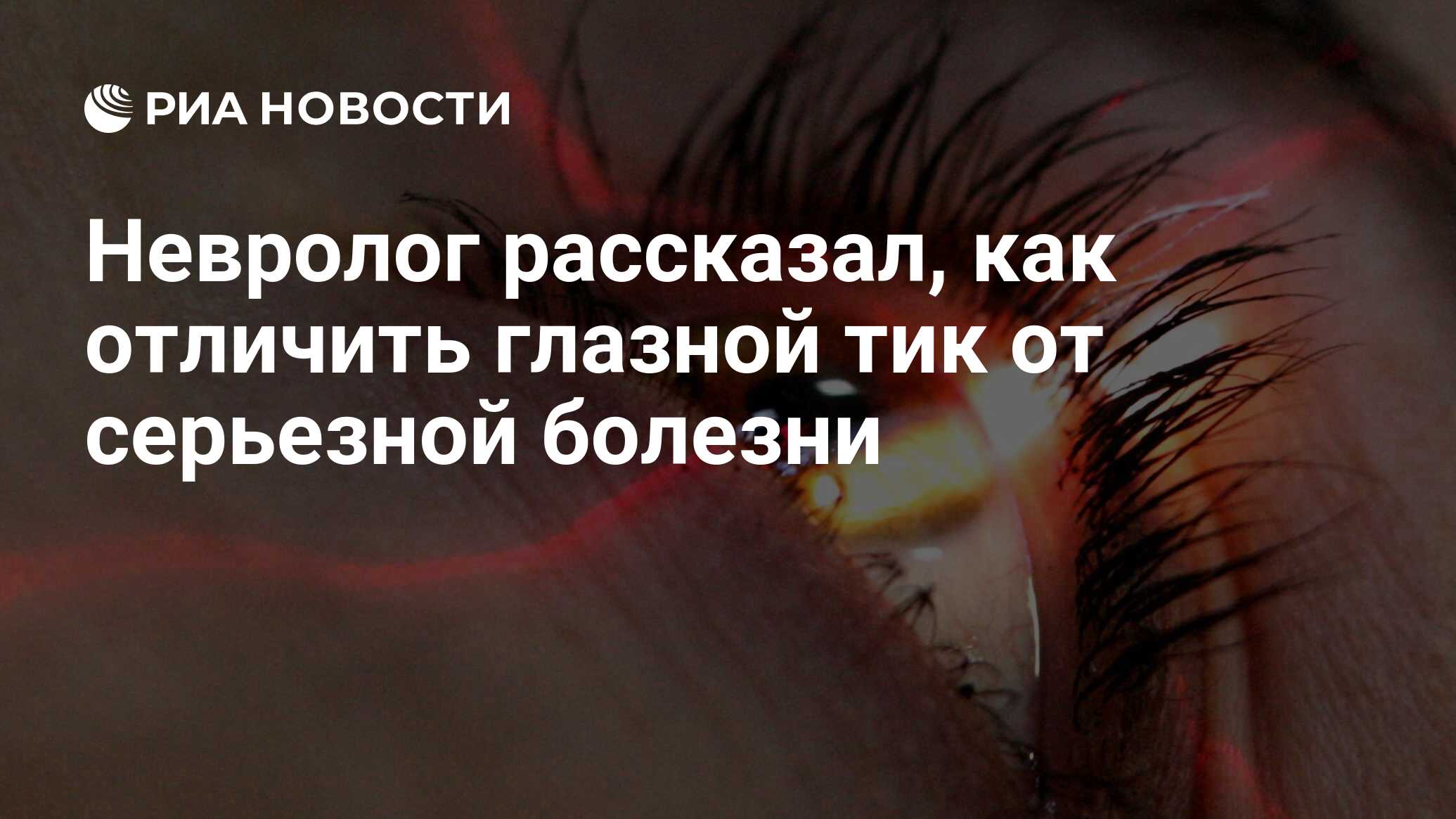 Невролог рассказал, как отличить глазной тик от серьезной болезни - РИА  Новости, 23.03.2021