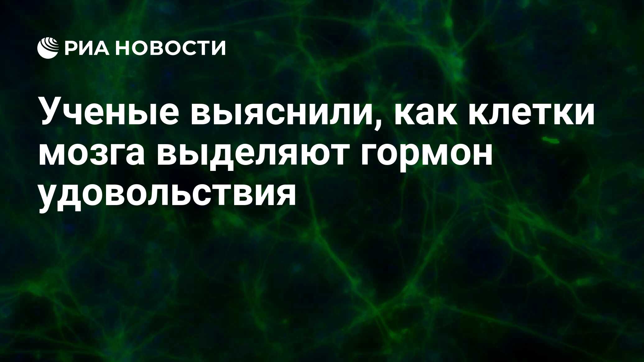 Ученые выяснили, как клетки мозга выделяют гормон удовольствия - РИА  Новости, 15.02.2022