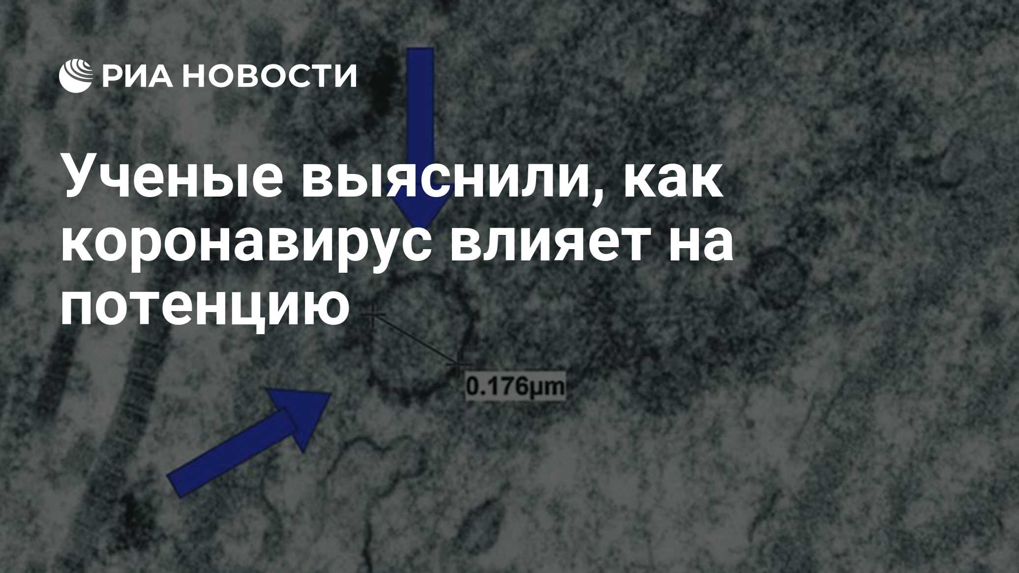 Ученые выяснили, как коронавирус влияет на потенцию - РИА Новости,  12.05.2021