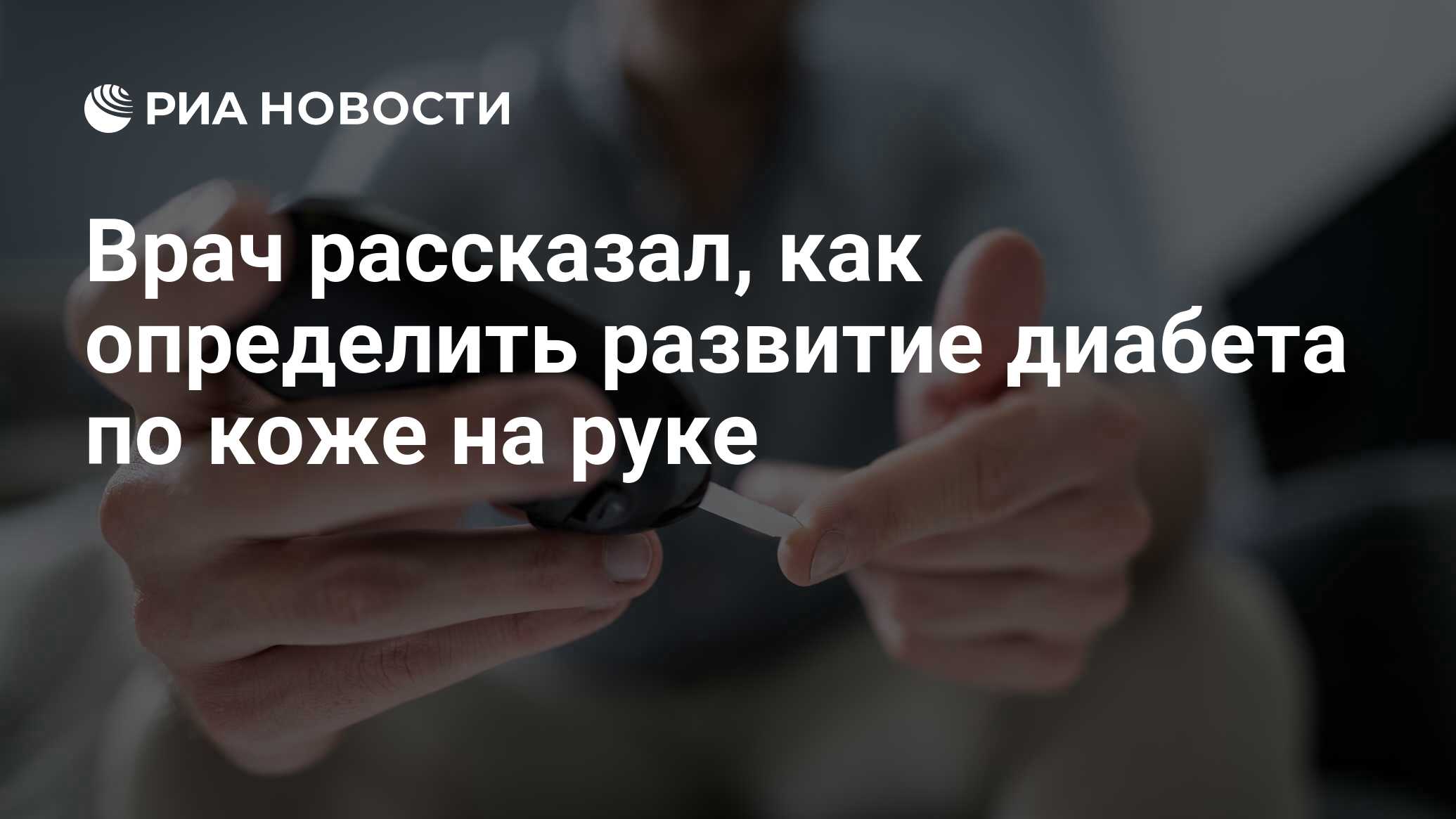 Врач рассказал, как определить развитие диабета по коже на руке - РИА  Новости, 24.08.2021