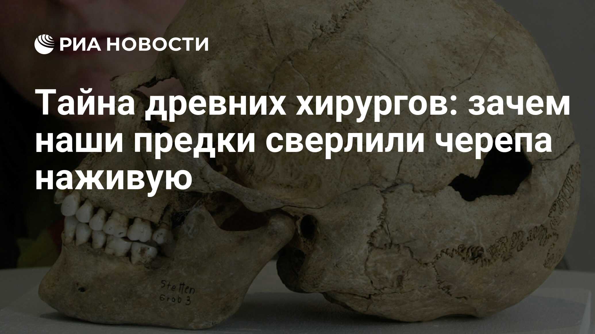 Тайна древних хирургов: зачем наши предки сверлили черепа наживую - РИА  Новости, 22.08.2021