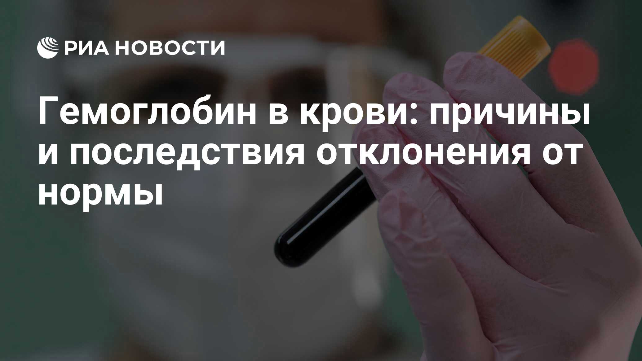 Гемоглобин в крови: норма у мужчин и женщин, что значит, уровень у взрослых