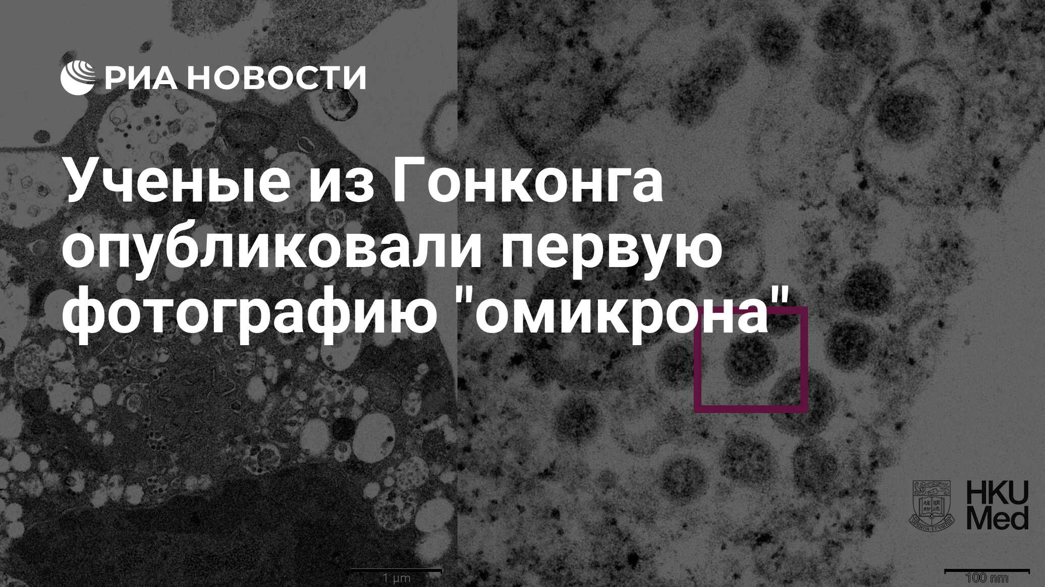 Университет гонконга опубликовал изображение омикрона