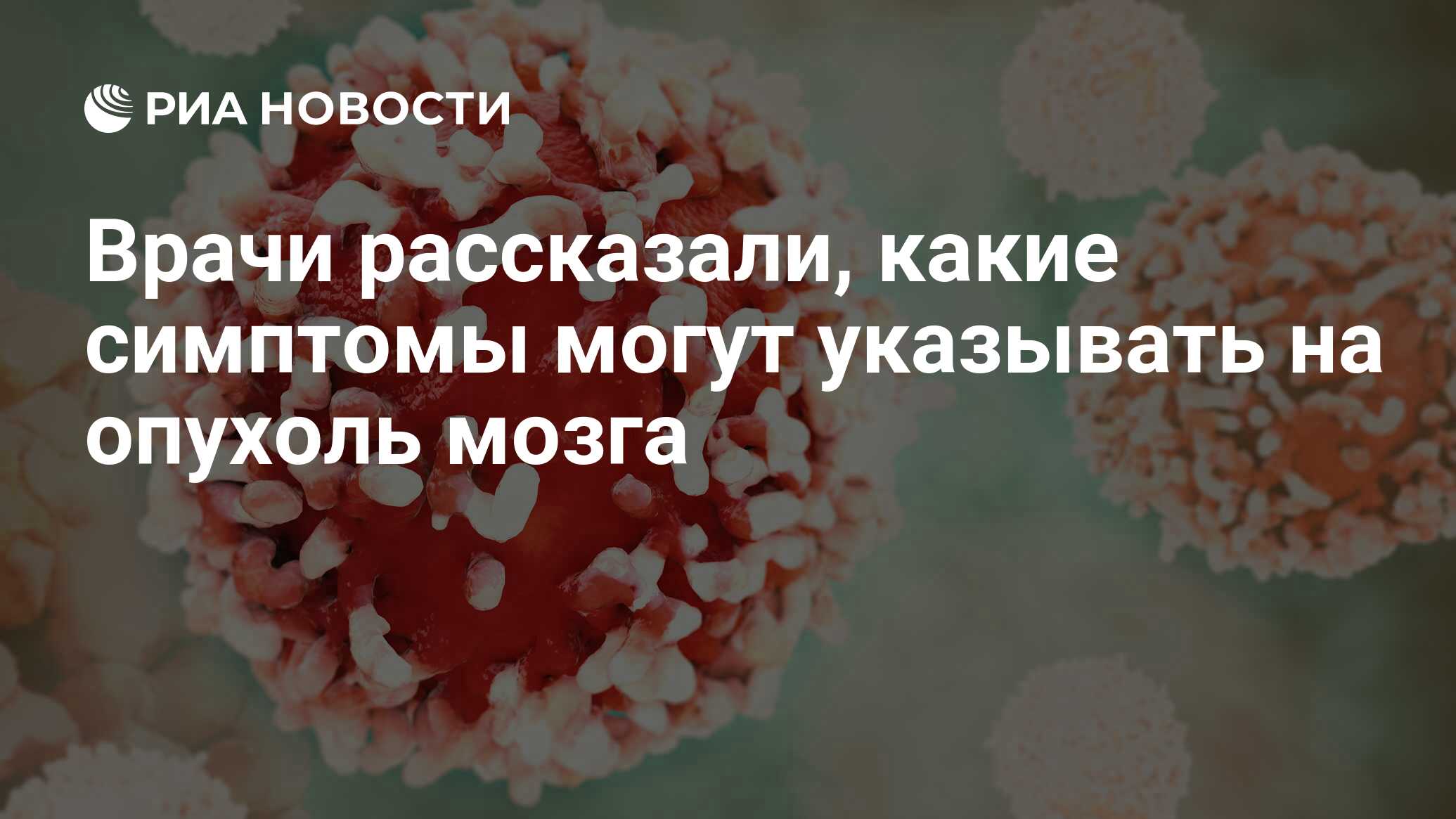 Врачи рассказали, какие симптомы могут указывать на опухоль мозга - РИА  Новости, 21.01.2022