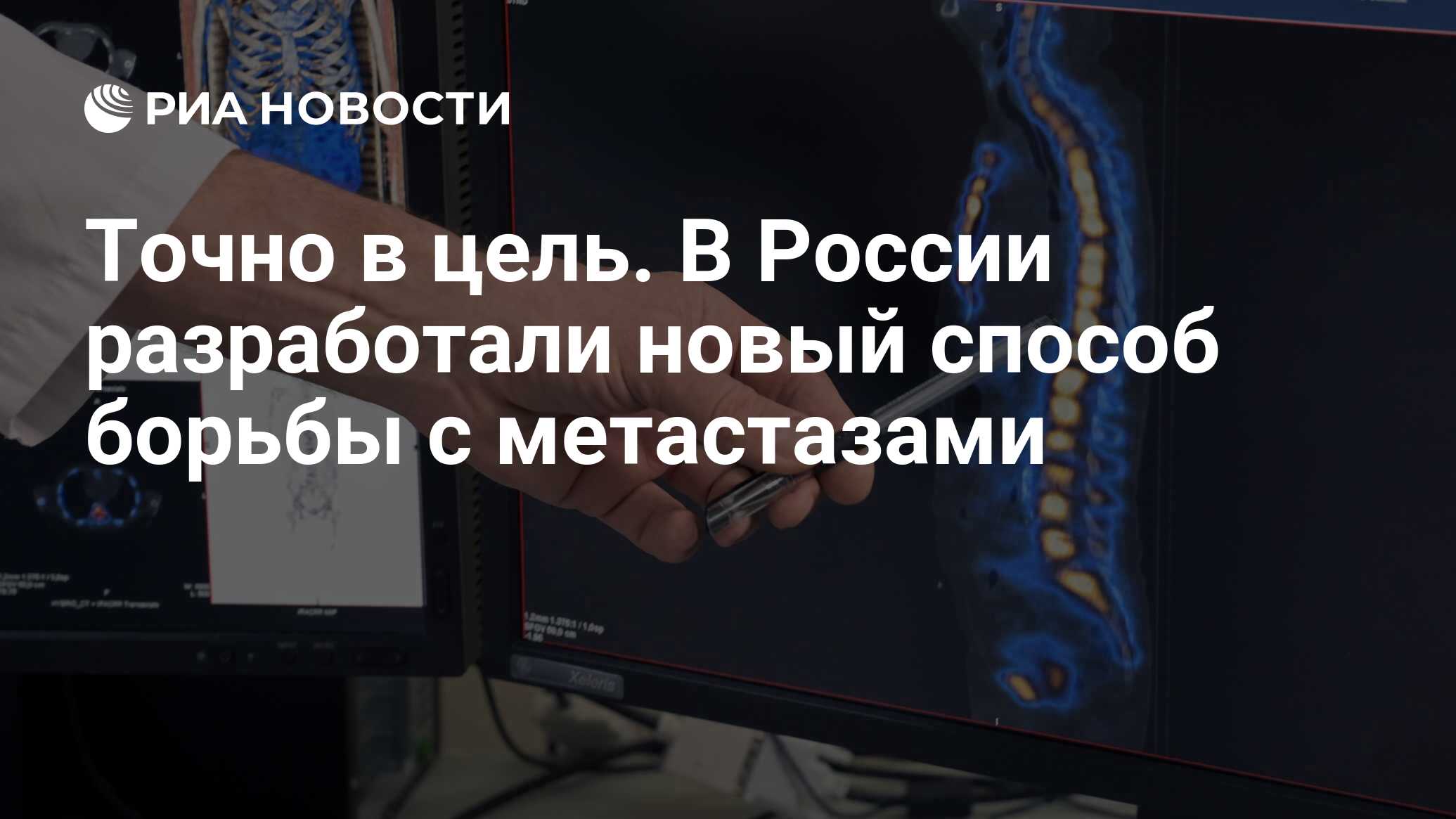 Точно в цель. В России разработали новый способ борьбы с метастазами - РИА  Новости, 04.02.2022