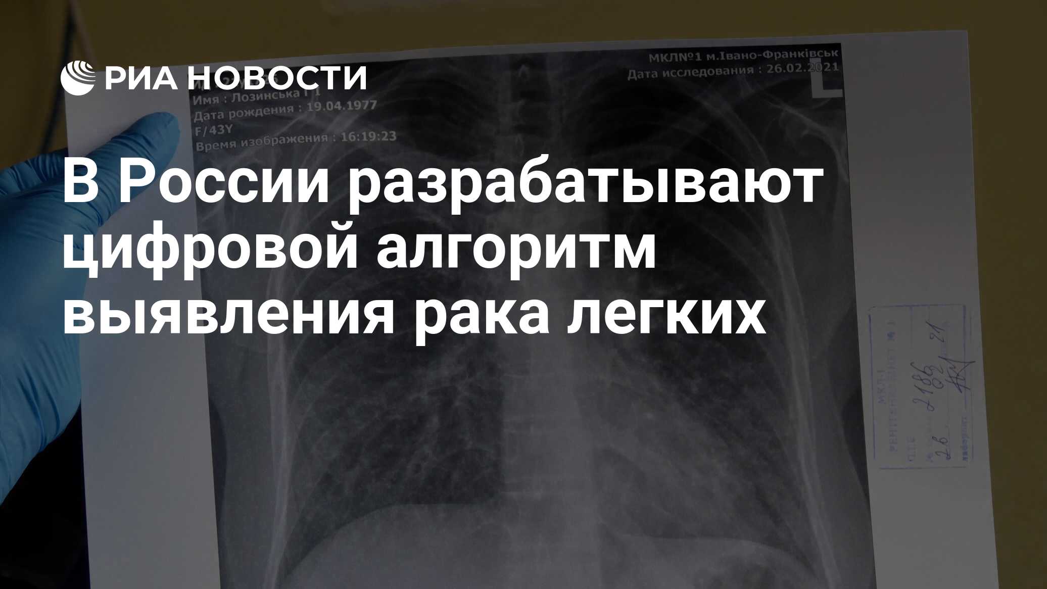 В России разрабатывают цифровой алгоритм выявления рака легких - РИА  Новости, 18.04.2022