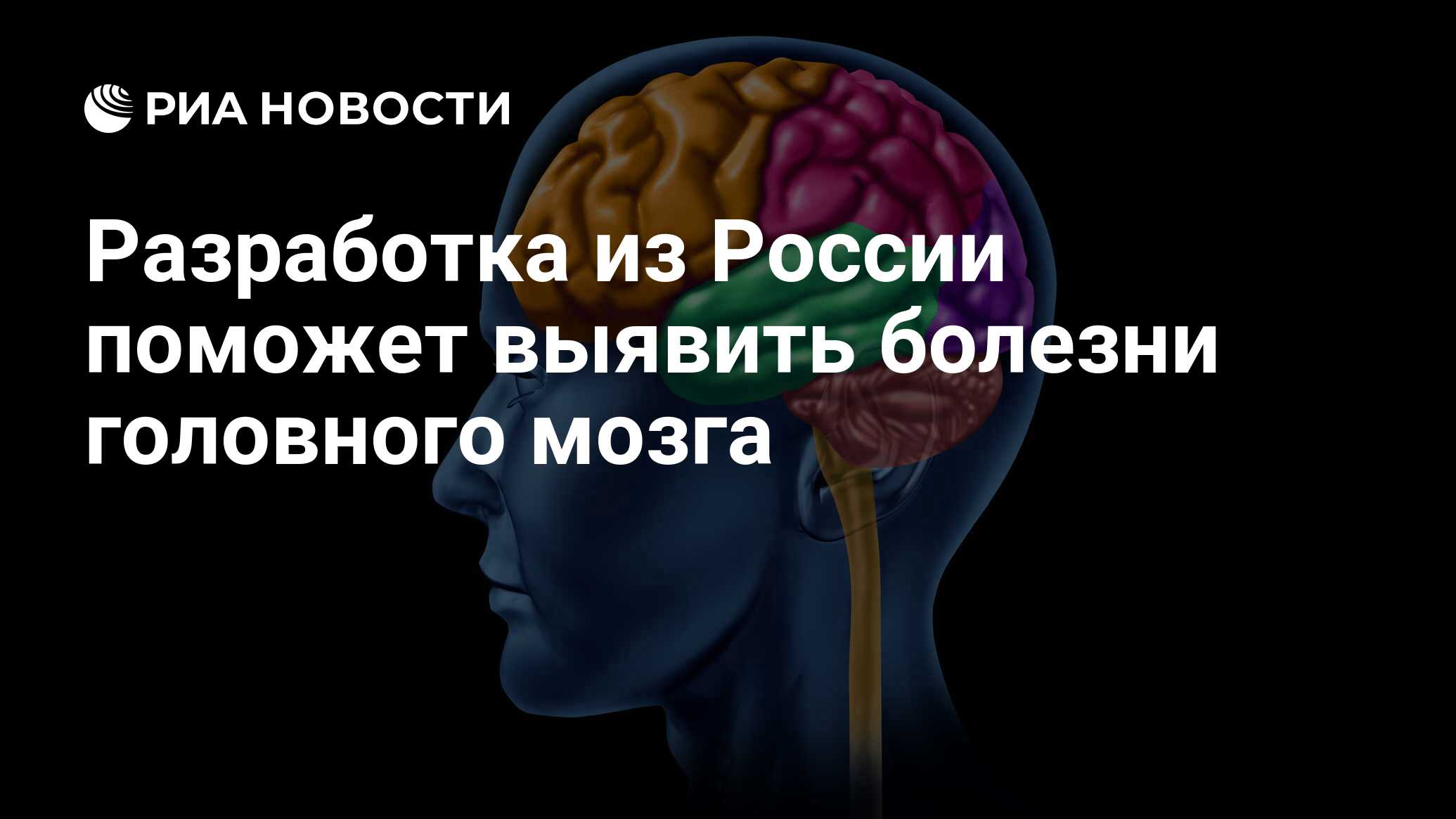 Разработка из России поможет выявить болезни головного мозга - РИА Новости,  13.07.2022