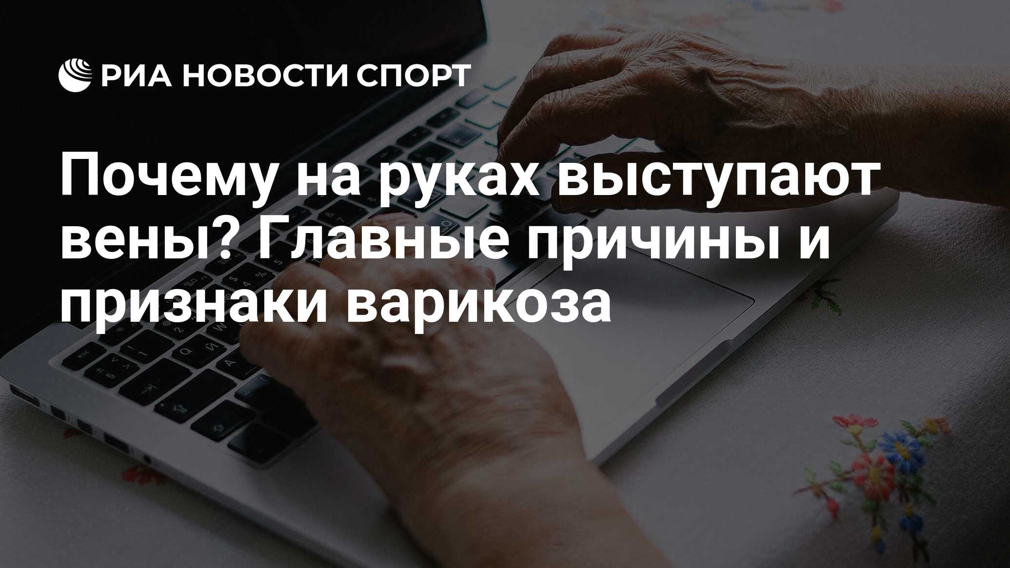 Почему на руках выступают вены и что делать при варикозе рук