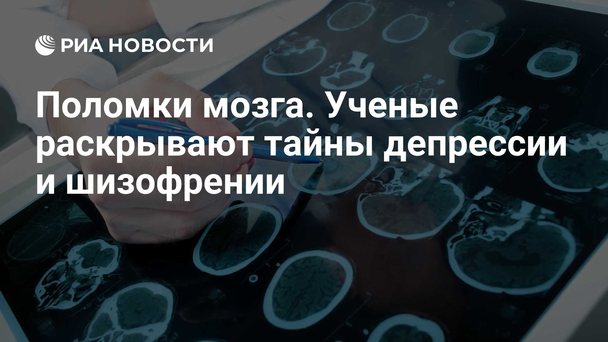 Поломки мозга. Ученые раскрывают тайны депрессии и шизофрении - РИА  Новости, 11.09.2022