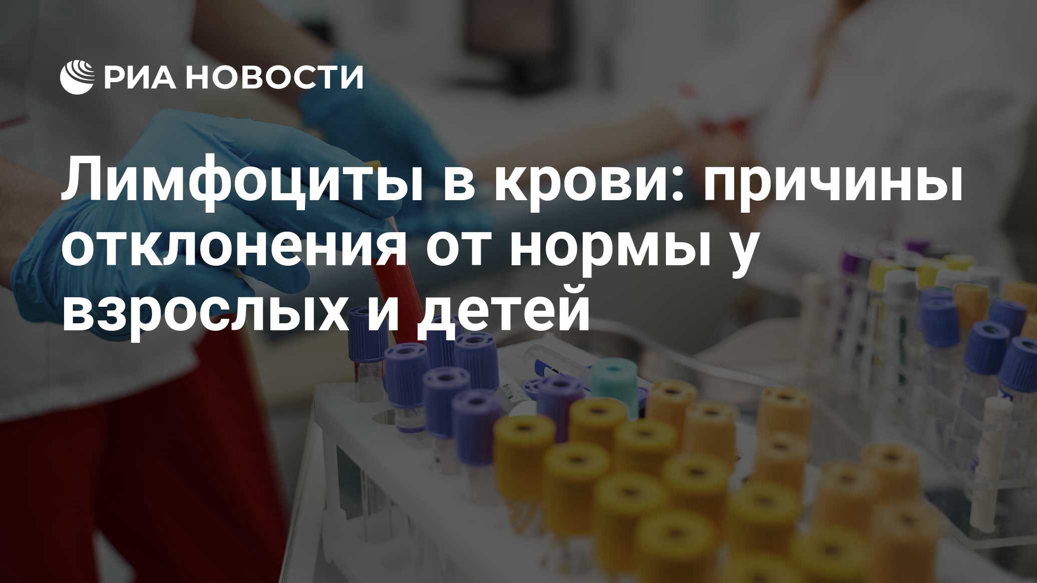 Лимфоциты в крови у взрослых: что значат, норма у мужчин и женщин,  повышены, понижены