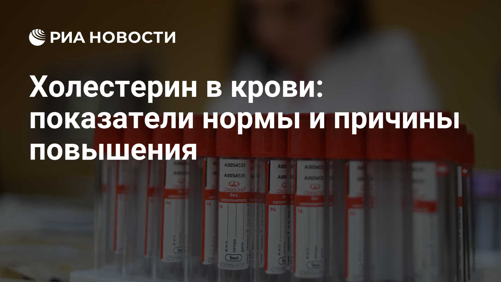 Холестерин в крови: норма уровня, таблица для женщин и мужчин по возрасту