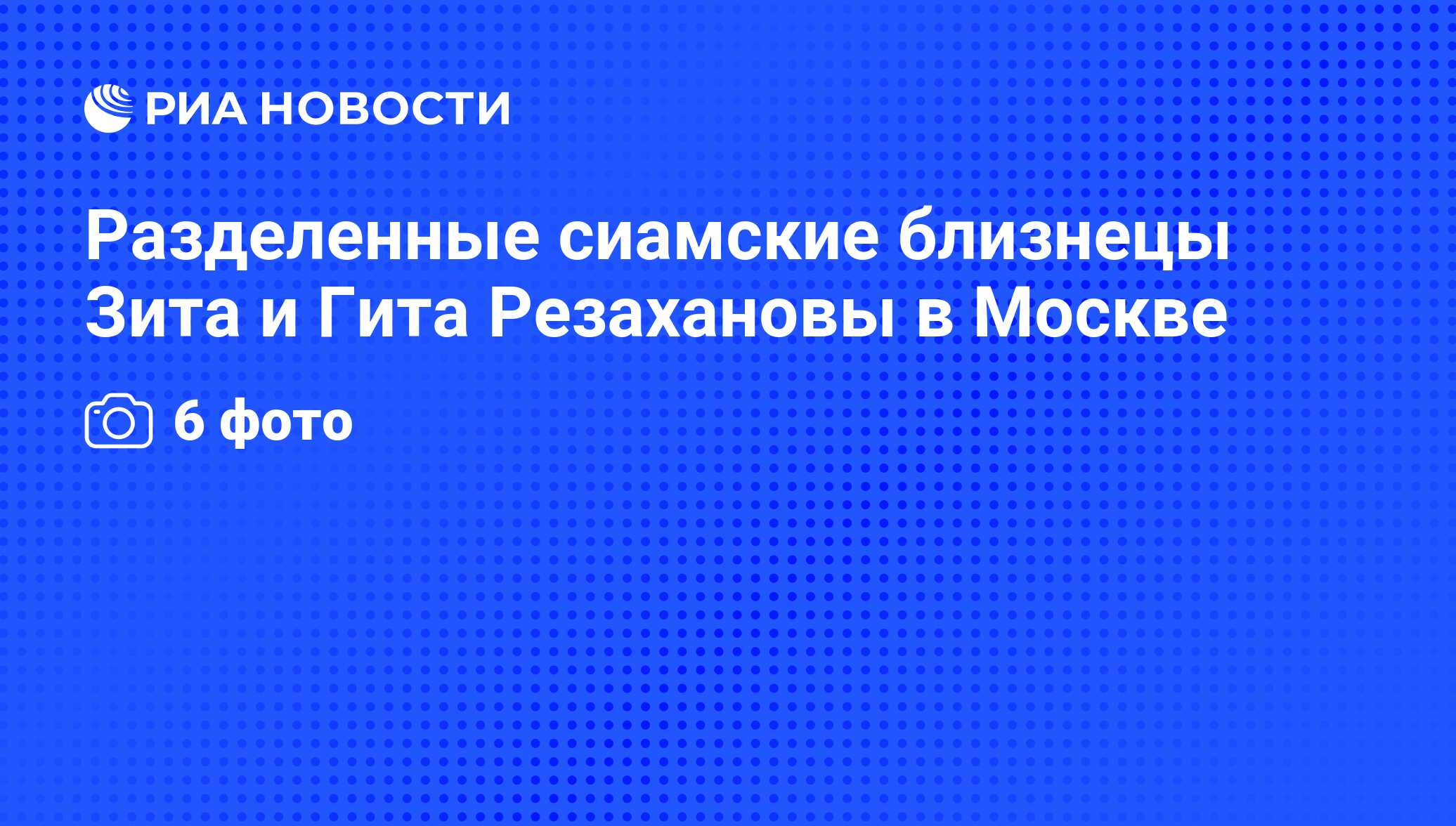 Разделенные сиамские близнецы Зита и Гита Резахановы в Москве - РИА  Новости, 17.09.2009