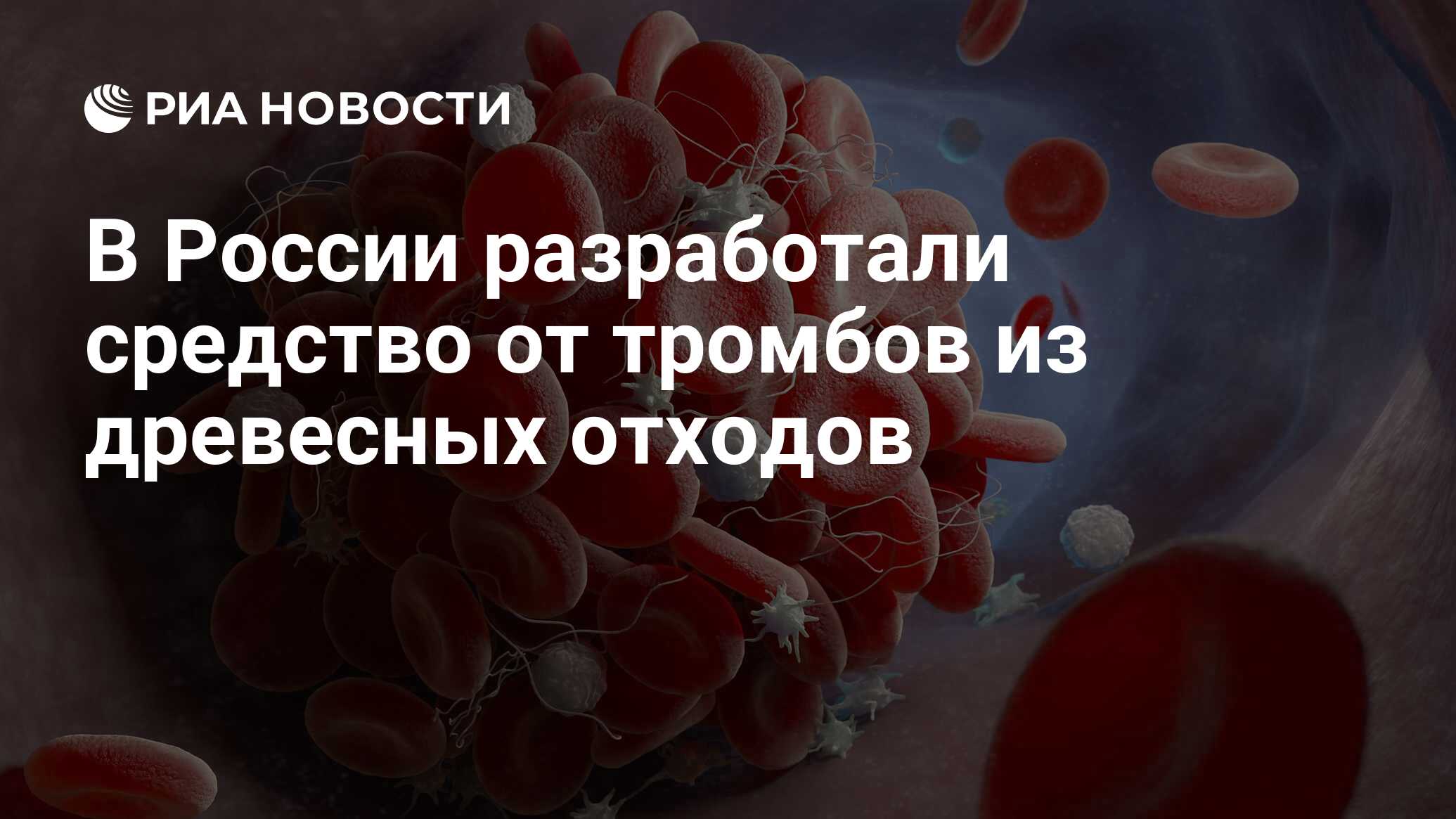 В России разработали средство от тромбов из древесных отходов - РИА  Новости, 14.03.2023