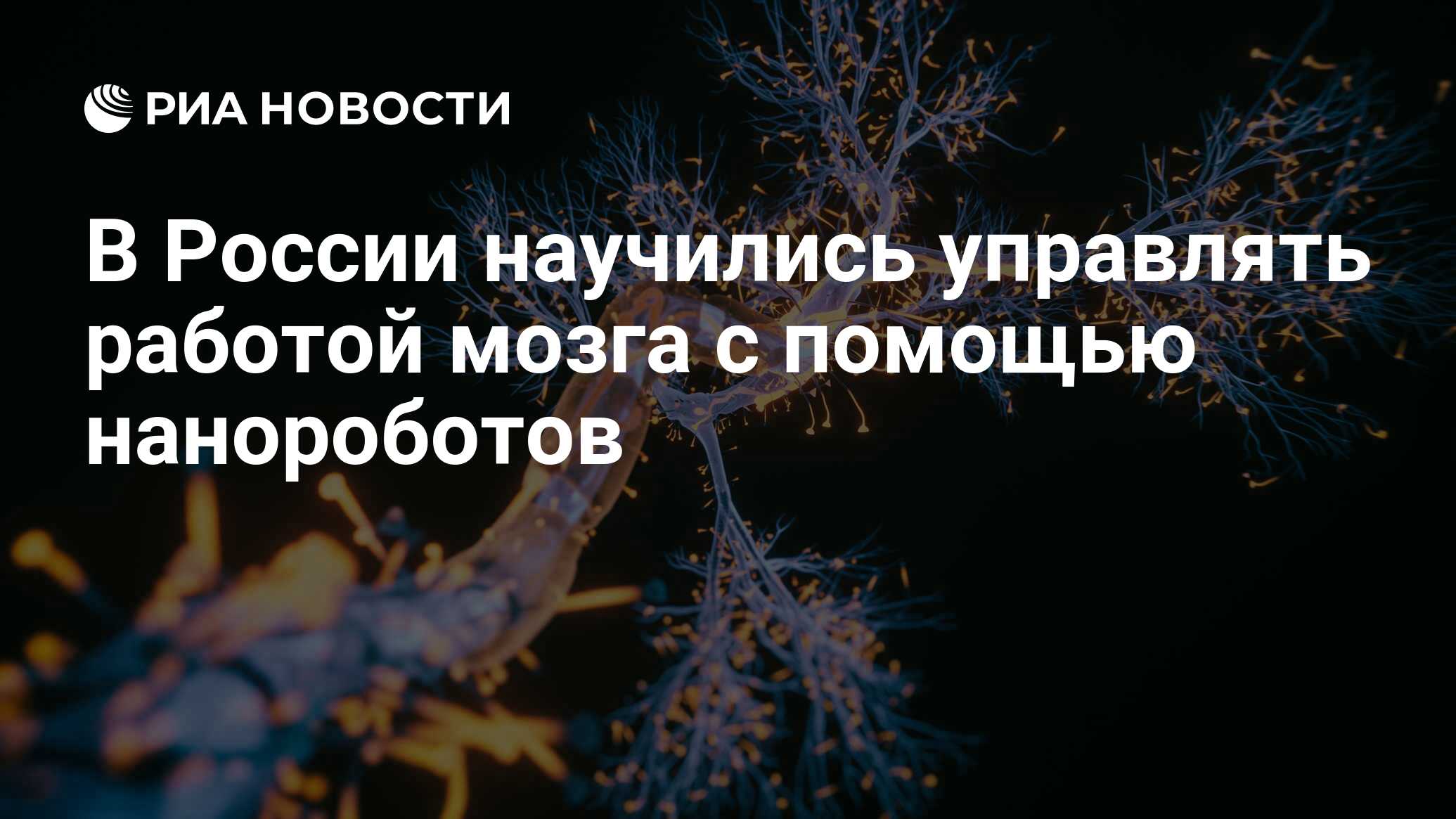 В России научились управлять работой мозга с помощью нанороботов - РИА  Новости, 27.11.2023