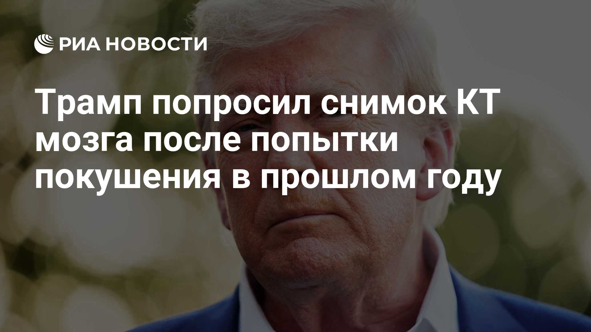 Трамп попросил снимок КТ мозга после попытки покушения в прошлом году