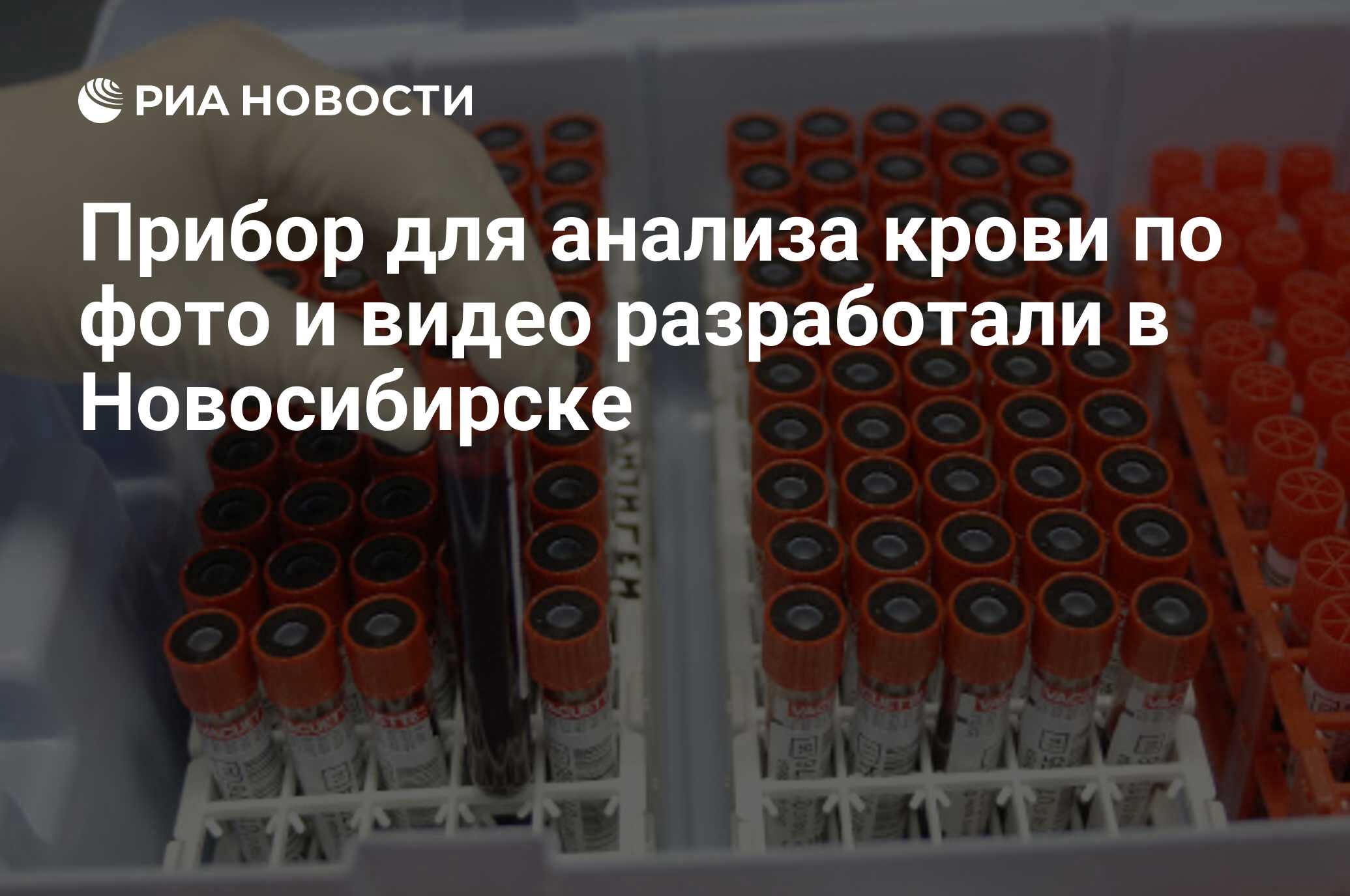 Прибор для анализа крови по фото и видео разработали в Новосибирске - РИА  Новости, 01.03.2020